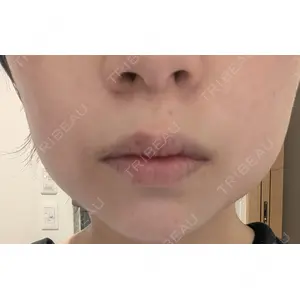 ルラ美容クリニック ルラ美容クリニック 広島院口コミ