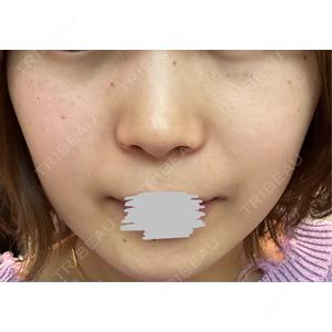 ルラ美容クリニック ルラ美容クリニック 静岡院口コミ