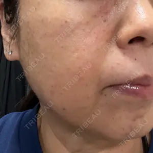 メディアージュクリニック de IMAGEクリニック恵比寿口コミ