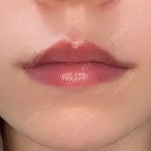 東京美容皮膚科アロエクリニック 東京美容皮膚科アロエクリニック池袋口コミ