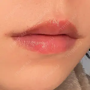 東京美容皮膚科アロエクリニック 東京美容皮膚科アロエクリニック池袋口コミ