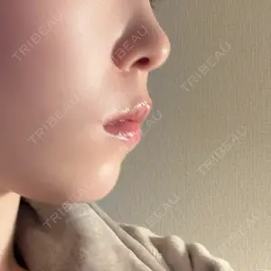 東京美容皮膚科アロエクリニック 東京美容皮膚科アロエクリニック池袋口コミ