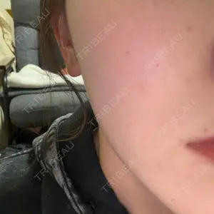 BITO BEAUTY CLINIC BITO BEAUTY CLINIC口コミ
