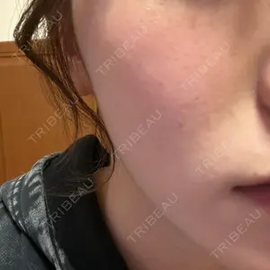 BITO BEAUTY CLINIC BITO BEAUTY CLINIC口コミ