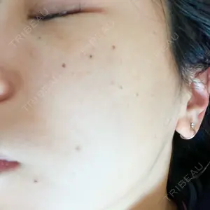 聖心美容クリニック グループ S-Laboクリニック 渋谷院口コミ