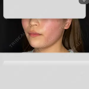 ルラ美容クリニック ルラ美容クリニック 新宿院口コミ