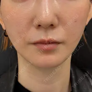 BLINC CLINIC （ブリンク クリニック）口コミ