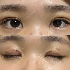 口コミ