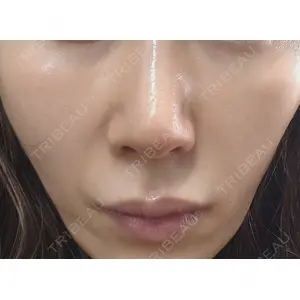 ヴェリテクリニック ヴェリテクリニック 銀座院口コミ