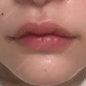 ECLA CLINIC ECLA CLINIC (エクラクリニック)口コミ