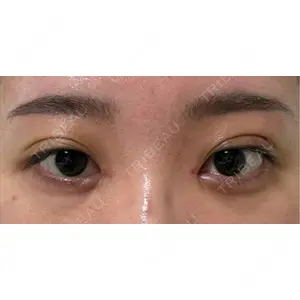 HAAB CLINIC HAAB×DREAM BEAUTY CLINIC 東京本院口コミ
