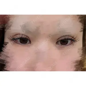 アイビークリニック 吉祥寺アイビークリニック口コミ