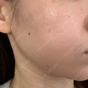 おおたかの森ビューティークリニック おおたかの森ビューティークリニック口コミ