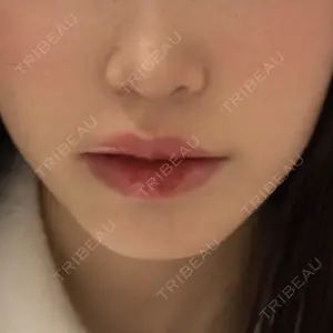 BiBiクリニック口コミ