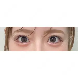 口コミ