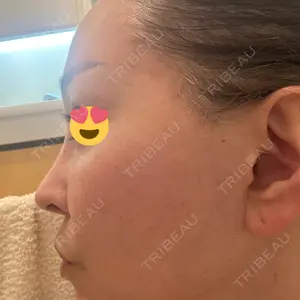 ASTRA BEAUTY CLINIC口コミ