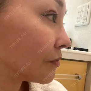 ASTRA BEAUTY CLINIC口コミ