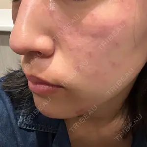 アクティブエイジクリニック アクティブエイジクリニック口コミ