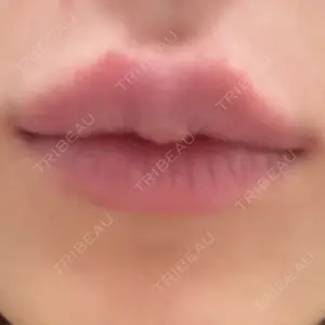 東京美容皮膚科アロエクリニック 東京美容皮膚科アロエクリニック池袋口コミ