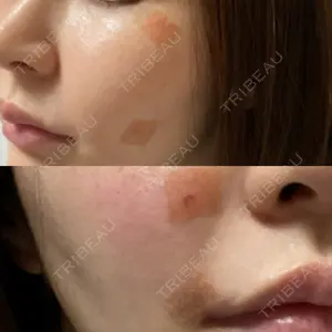 KARIS beauty clinic口コミ