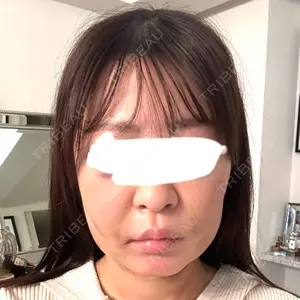 Nebula Clinic 新宿美容外科ネビュラクリニック口コミ