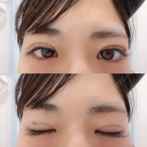 東京シンデレラ美容外科 東京シンデレラ美容外科 大宮院口コミ