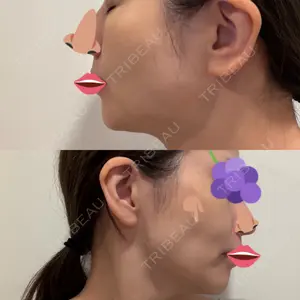 PRISM Beauty Clinic  PRISM Beauty Clinic 新宿院口コミ