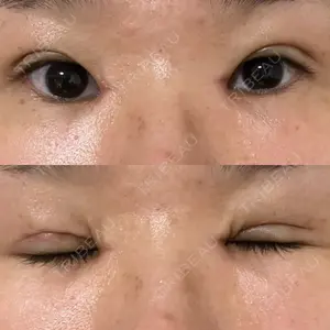 EMMA CLINIC（エマクリニック）口コミ