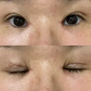 EMMA CLINIC（エマクリニック）口コミ