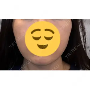 グレーススキンクリニック グレーススキンクリニック口コミ