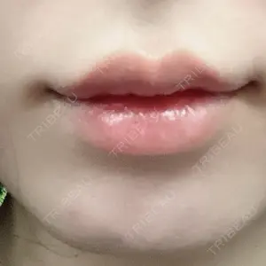 ECLA CLINIC ECLA CLINIC (エクラクリニック)口コミ