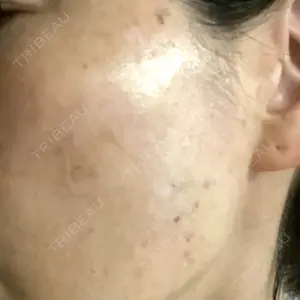 聖心美容クリニック グループ S-Laboクリニック 渋谷院口コミ