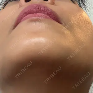 口コミ