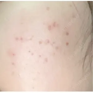 ルラ美容クリニック ルラ美容クリニック 郡山院口コミ