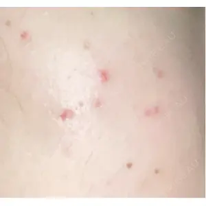 ルラ美容クリニック ルラ美容クリニック 郡山院口コミ