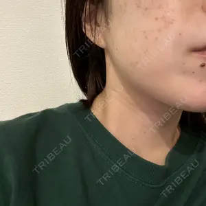 聖心美容クリニック グループ S-Laboクリニック 渋谷院口コミ