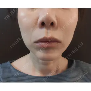 池袋美容クリニック 池袋美容クリニック口コミ