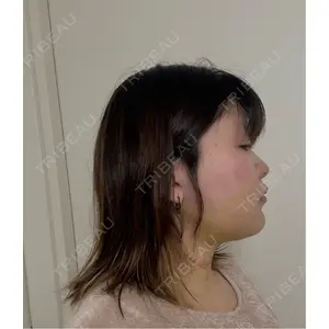 Nebula Clinic 新宿美容外科ネビュラクリニック口コミ