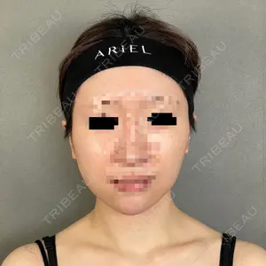 アリエル美容クリニック アリエル美容クリニック 大宮院口コミ