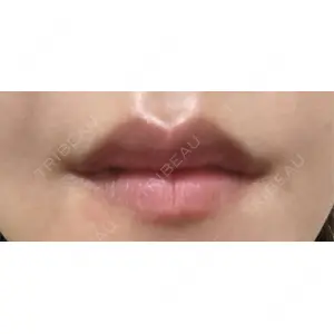 口コミ