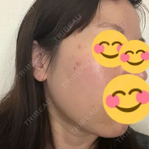 BBC BBC表参道院口コミ