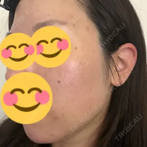 BBC BBC表参道院口コミ