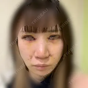 口コミ