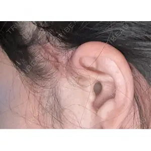 グレーススキンクリニック グレーススキンクリニック口コミ