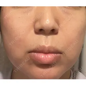 Fellez Clinic【フェルズクリニック】口コミ