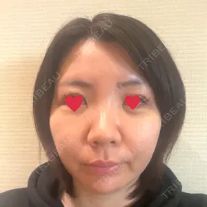 TCB東京中央美容外科 TCB東京中央美容外科 新宿東口院口コミ