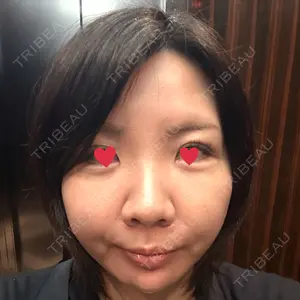 TCB東京中央美容外科 TCB東京中央美容外科 新宿東口院口コミ