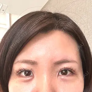 TCB東京中央美容外科 TCB東京中央美容外科 新宿東口院口コミ