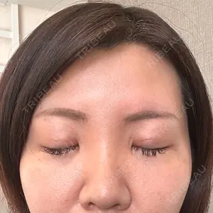 TCB東京中央美容外科 TCB東京中央美容外科 新宿東口院口コミ