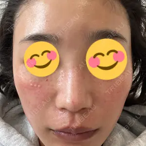 美容皮膚科ティファクリニック 美容皮膚科ティファクリニック 新宿東口口コミ